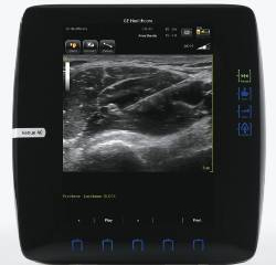 GEヘルスケア・ジャパンの麻酔科用超音波装置