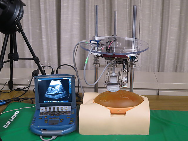 超音波診断ロボット
